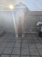 露出