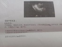 我嫂子，差点被大哥抓现形，老实没几天嫂子怀孕了，我的！0