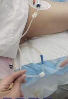 女病人手术后回病房走光