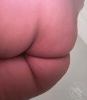不止痒啊这