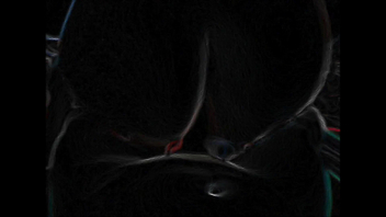 母狗—全自动榨汁机