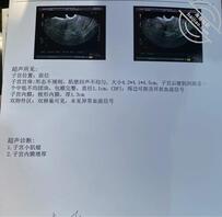 292、和姐姐在户外操完逼后，终究还是出现问题了1