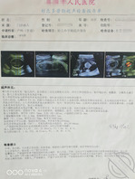 不知道是不是我把我妈搞怀孕的1