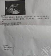 老婆怀孕了只能射嘴里了，有没有想一起射我老婆嘴里的0