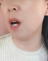 80年阿姨骚蝴蝶屄脱毛前后，有毛跟无毛的你更喜欢哪一款，评论区告诉阿姨0