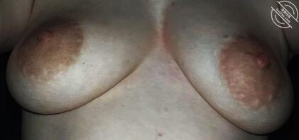 母狗怀孕时的大乳晕和骚逼，有比这母狗乳晕还大的吗？发评论区看看0