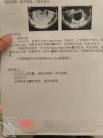 ［原创］听你们的建议内射老姐，结果把老姐干怀孕了
