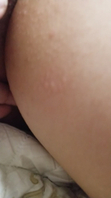 肥逼
