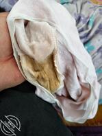 我妹好像被干出病了,逼里有分泌物把内裤都搞变色了还闻着味道好骚0