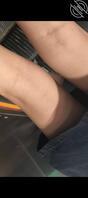 扶梯抄底1